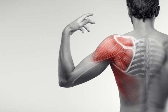 Seeking shoulder pain relief in Santa Rosa?